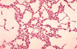Znaczenie słowa Bacillus w encyklopedii biologia „Kosmiczne” Bacillus Bacillus Safensis