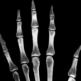 Röntgeniuuringu peamised meetodid on fluoroskoopia ja radiograafia